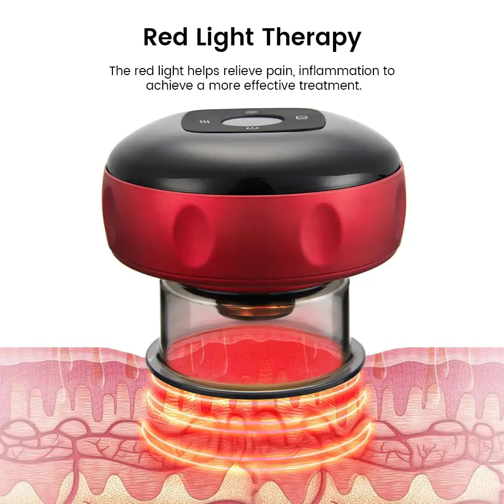 Electric Vacuum Cupping Massager | Anti-Cellulite Cupping Set Electric