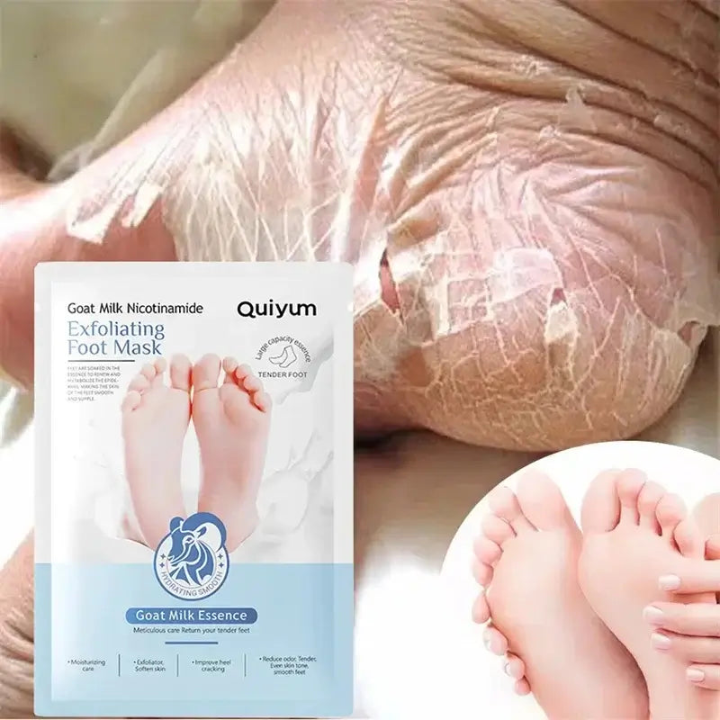 Herbal Remedy For Cracked Heels | Best Ayurvedic Foot Cream For Cracks
