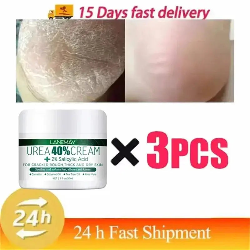 Herbal Remedy For Cracked Heels | Best Ayurvedic Foot Cream For Cracks
