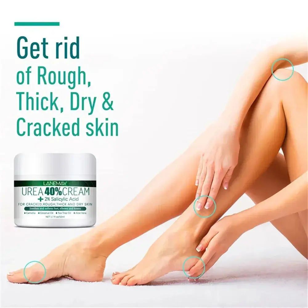 Herbal Remedy For Cracked Heels | Best Ayurvedic Foot Cream For Cracks
