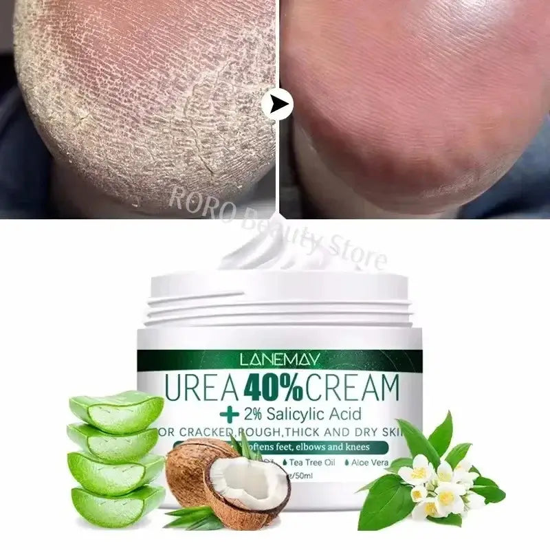 Herbal Remedy For Cracked Heels | Best Ayurvedic Foot Cream For Cracks
